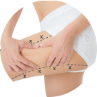 Showcasing of regions where the fat deposits occour on womens thighs